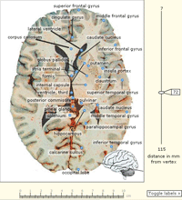 A colour atlas of the human brain