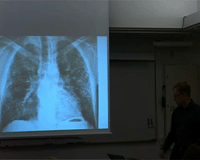 Lungsjukdomar