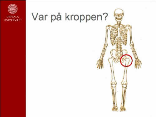 Ortopedisk omvrdnad - Vrd och behandling vid fraktur (24 min)