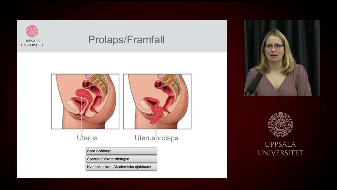 Prolapsframfall del 1 - Medfarm Play - Uppsala universitet