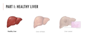 Förhandsvisning (thumbnail) från videon Frontier lecture Liver - part 1