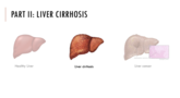 Förhandsvisning (thumbnail) från videon Frontier lecture Liver - part 2