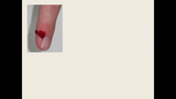 Förhandsvisning (thumbnail) från videon Hemostas 1