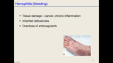 Förhandsvisning (thumbnail) från videon Hemostas 4