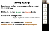 Förhandsvisning (thumbnail) från videon Fredrik PontÃ©n - Tumörpatologi