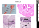 Förhandsvisning (thumbnail) från videon Fredrik PontÃ©n Gastrointestinal patologi inspelat från zoom