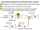 Förhandsvisning (thumbnail) från videon 07 Monogena sjukdomar (3)