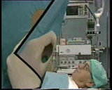 Förhandsvisning (thumbnail) från videon Anesthesia - Epidural anesthesia