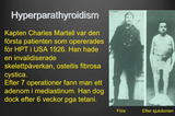 Förhandsvisning (thumbnail) från videon Hyperparathyroidism