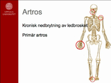 Förhandsvisning (thumbnail) från videon Ortopedisk omvårdnad - Artros (6 min)