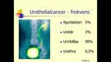 Förhandsvisning (thumbnail) från videon Urinblåsecancer-PerUno-Malmstrom-2014