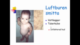 Förhandsvisning (thumbnail) från videon Basala Hygienrutiner Del 2