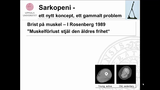 Förhandsvisning (thumbnail) från videon Undernäring vid sjukdom, åldrande, kakexi och sarkopeni Del 2