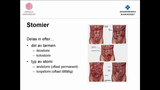 Förhandsvisning (thumbnail) från videon Nedre gastrointestinal kirurgi Del 2