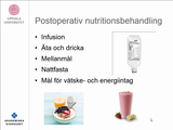 Förhandsvisning (thumbnail) från videon Pre- och postoperativ nutrition Del 2 (POST)