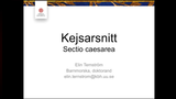 Förhandsvisning (thumbnail) från videon Kejsarsnitt