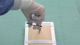Förhandsvisning (thumbnail) från videon Exempel pÃ¥ hur man stoppar blÃ¶dning pÃ¥ operation
