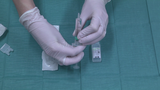Förhandsvisning (thumbnail) från videon Att kuffa om ballong på gastrostomiknapp