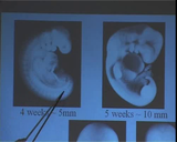 Förhandsvisning (thumbnail) från videon Embryology with Bill Webster - Limb development