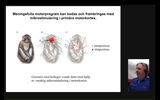 Förhandsvisning (thumbnail) från videon 4. Övre motorneurons funktion