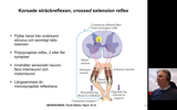 Förhandsvisning (thumbnail) från videon 14. Korsade sträckreflexen och CMG