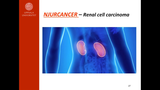 Förhandsvisning (thumbnail) från videon Urologisk cancer, del 2 (3:3)